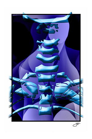 Custom Deep Blue AP Cervical