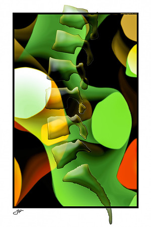 Brown Lateral Lumbar
