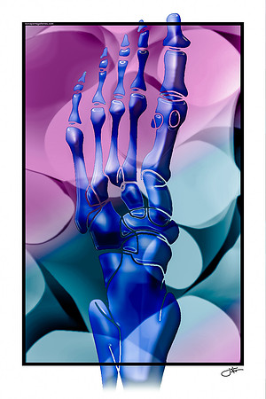 PURPLE AP Foot