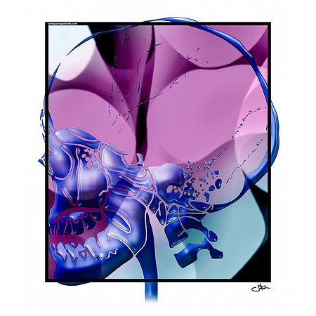 PURPLE Lateral Skull