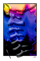 Rainbow Lateral Cervical Spine 2